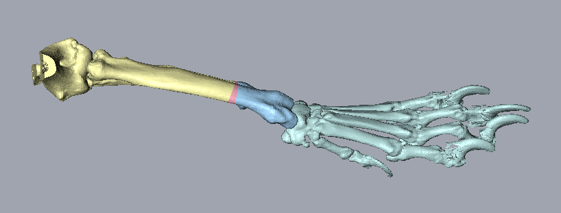 3D-planned correction of a forelimb angular limb deformity
